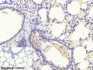 Phospho-STAT1 (Tyr701) Polyclonal Antibody