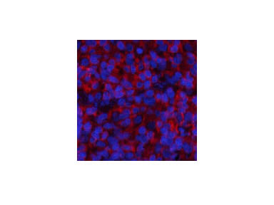 Phospho-STAT1 (Tyr701) Polyclonal Antibody