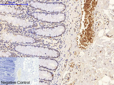 Phospho-P38 (Thr180/Tyr182) Polyclonal Antibody