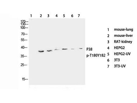 Phospho-P38 (Thr180/Tyr182) Polyclonal Antibody