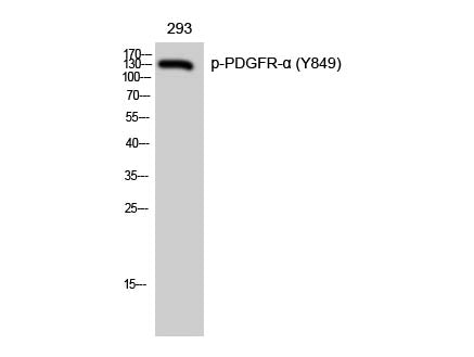 Phospho-PDGFRA (Tyr849) Polyclonal Antibody