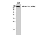 Phospho-PDGFRA (Tyr849) Polyclonal Antibody