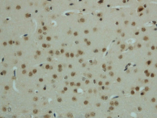 Phospho-AMPK alpha1/2 (Thr183/172) Polyclonal Antibody
