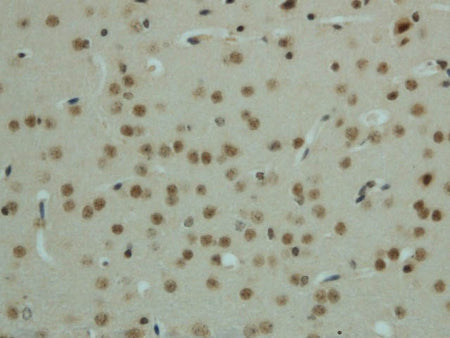 Phospho-AMPK alpha1/2 (Thr183/172) Polyclonal Antibody