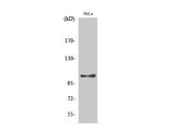 Phospho-EEF2K (Ser366) Polyclonal Antibody