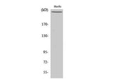 Phospho-FLNA (Ser2152) Polyclonal Antibody