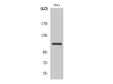 Phospho-STAT2 (Tyr690) Polyclonal Antibody
