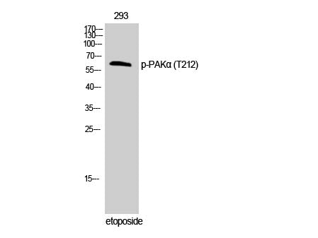 Phospho-PAK1 (Thr212) Polyclonal Antibody