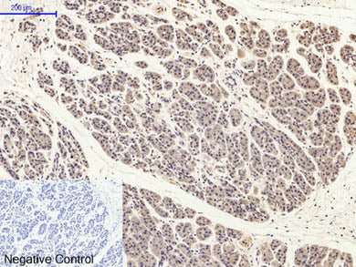 Phospho-FAK (Tyr397) Polyclonal Antibody