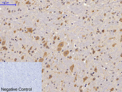 Phospho-FAK (Tyr397) Polyclonal Antibody
