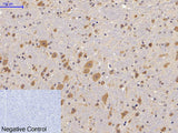 Phospho-FAK (Tyr397) Polyclonal Antibody