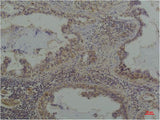 Phosphoserine Monoclonal Antibody