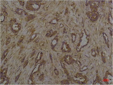 Phosphoserine Monoclonal Antibody