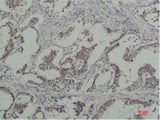Phosphotyrosine Monoclonal Antibody