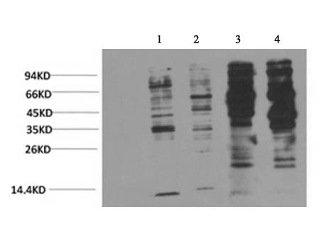 Phosphotyrosine Monoclonal Antibody