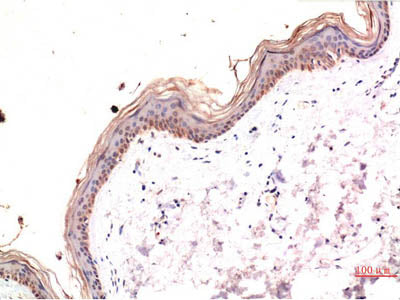 Phospho-MLKL (Ser358) Monoclonal Antibody