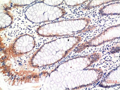 Phospho-MLKL (Ser358) Monoclonal Antibody