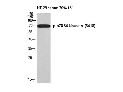 Phospho-p70 S6 Kinase Alpha (Ser418) Polyclonal Antibody