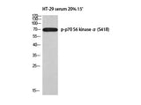Phospho-p70 S6 Kinase Alpha (Ser418) Polyclonal Antibody