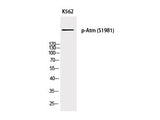 Phospho-ATM (Ser1981) Polyclonal Antibody