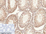 PCNA Monoclonal Antibody