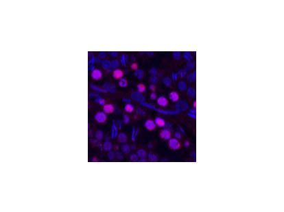 PCNA Monoclonal Antibody
