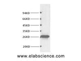 BCL2 Monoclonal Antibody