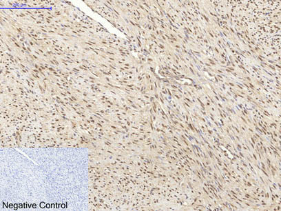 HSP70 Monoclonal Antibody