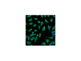 HSP70 Monoclonal Antibody