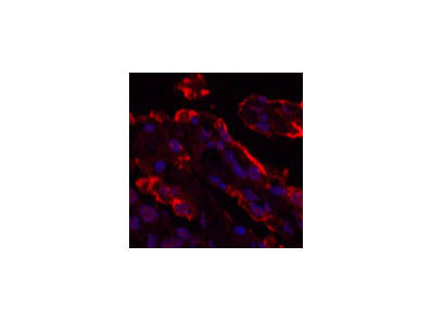 Galectin 3 Monoclonal Antibody Store at -20°C Reactivity Human