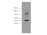 Galectin 3 Monoclonal Antibody Store at -20°C Reactivity Human