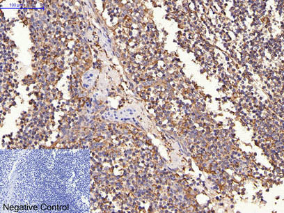ERBB2 Monoclonal Antibody