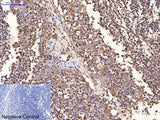 ERBB2 Monoclonal Antibody