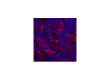 ERBB2 Monoclonal Antibody
