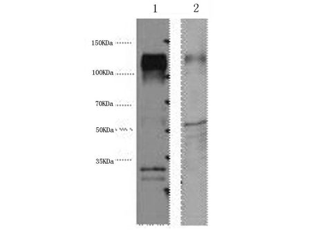 ERBB2 Monoclonal Antibody