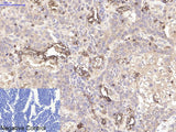 CD45 Monoclonal Antibody
