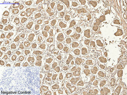 AMACR Monoclonal Antibody