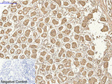AMACR Monoclonal Antibody