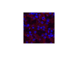 AMACR Monoclonal Antibody