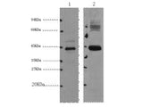 AMACR Monoclonal Antibody