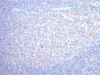 CD68 Monoclonal Antibody
