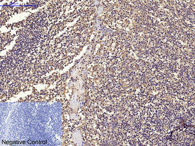 CD68 Monoclonal Antibody