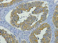 CK-19 Monoclonal Antibody