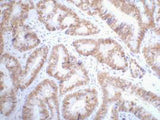 P53 Monoclonal Antibody
