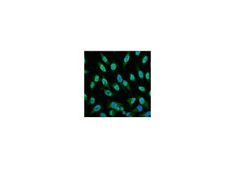 P53 Monoclonal Antibody