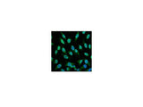 P53 Monoclonal Antibody