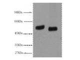 P53 Monoclonal Antibody