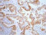 CK-7 Monoclonal Antibody