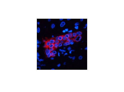 CK-7 Monoclonal Antibody