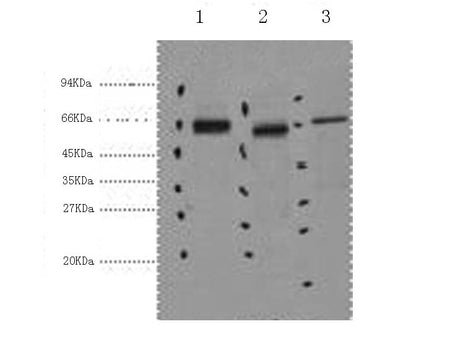 CK-7 Monoclonal Antibody